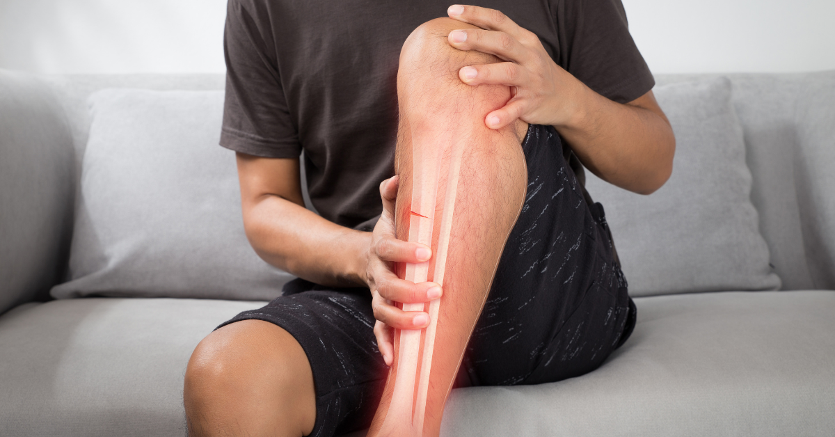 Stress Fractures: Small Cracks, Big Problems