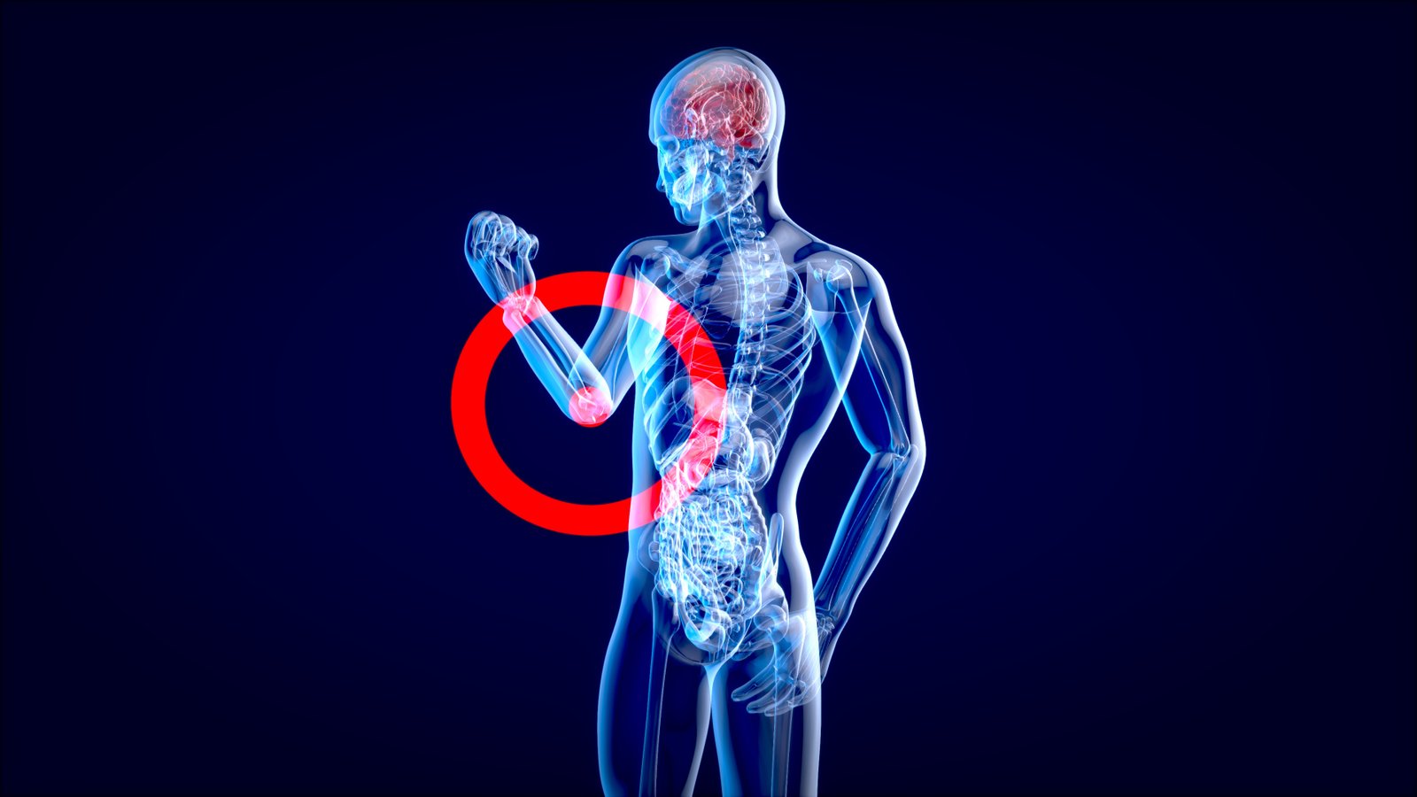 Why Do Bones Take Longer to Heal in Some People? Factors Affecting Recovery
