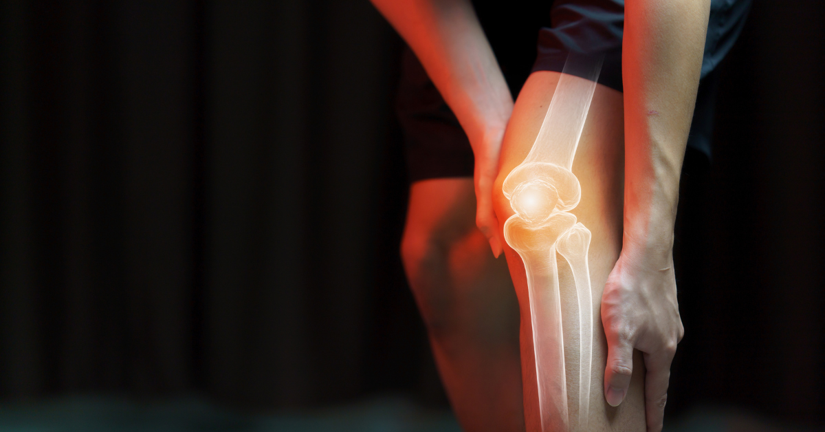 Conquering Knee Pain: When is Surgery the Answer?