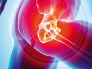 Knee implant specialist in delhi