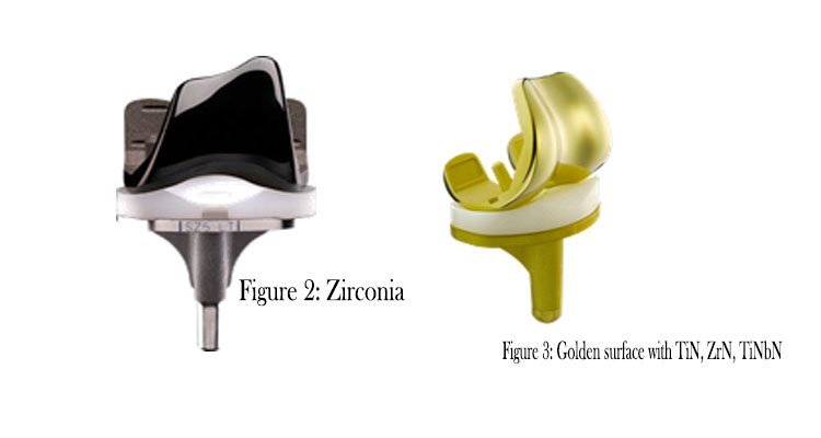 Knee replacement surgeon in Delhi